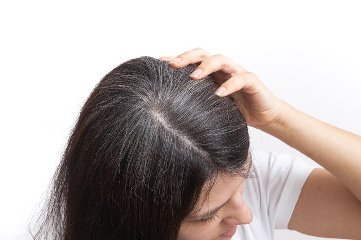 Certain foods rich in nutrients help delay hair graying and maintain healthy natural color.